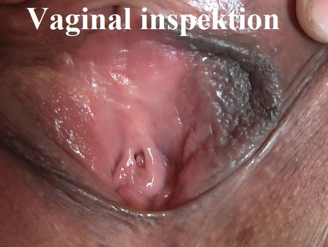 Vaginal inspektion